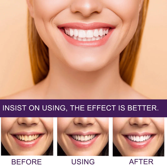 2 Pcs Teeth Whitening Tooth Paste